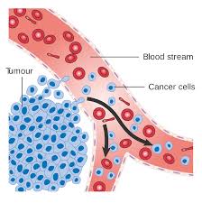 CÉLULAS EM AZUL DO TUMOR (CANCER CELLS),
INVADINDO VASO SANGUÍNEO (BLOOD STREAM).